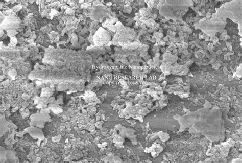 Hydroxyapatite Nanoparticles/ Nanopowder at Rs 10/gram | Jadugoda Mines | Jamshedpur | ID ...