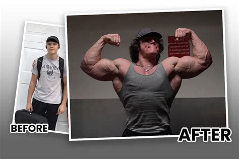 Bodybuilder Sam Sulek Before and After - Gymfluencers America