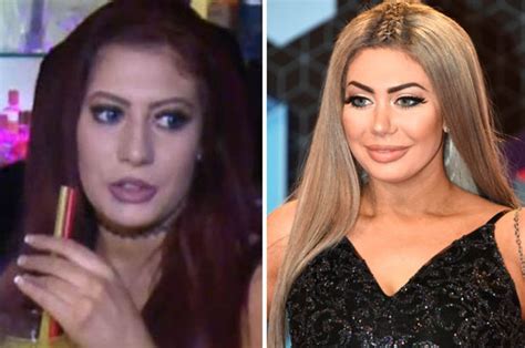 Geordie Shore cast plastic surgery: Before and after pics will shock | Daily Star