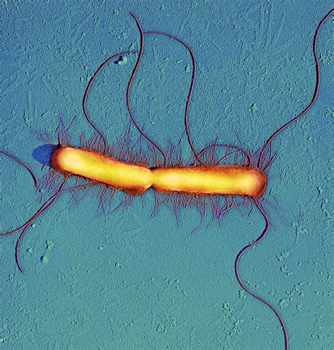 Proteus Vulgaris Bacteria, Sem Photograph by Thomas Deerinck, Ncmir