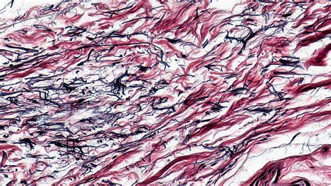 Connective Tissue: Human Elastic Tissue | cross section: hum… | Flickr