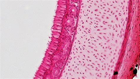 Epithelial Tissues: Pseudostratified Columnar Epithelium | Flickr