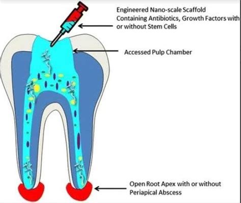 Engineered nano-scale scaffold for the regenerative endodontics ...