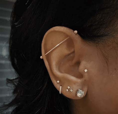 Infected Ear Cartilage Piercing