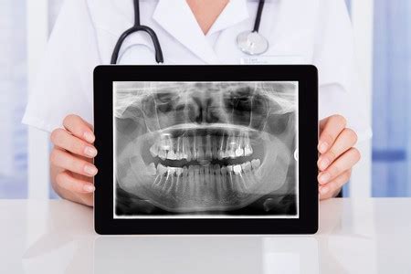 Dental Digital X-ray vs Film Radiation – Why Digital Is Better