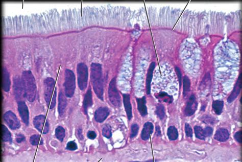 Ciliated Simple Columnar Epithelium Location - Goimages Signs