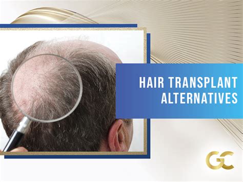 Hair Transplant Alternatives - Gold City Best Hair Transplant Turkey