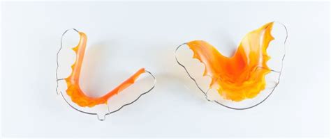 How Much Is a Replacement Retainer? - OC Dental Center