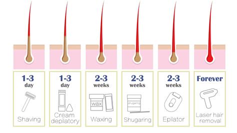 The Difference Between IPL and Laser Hair Removal - & How To Choose