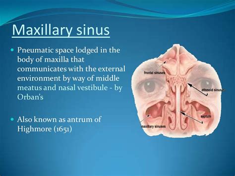 Surgical anatomy of maxillary sinus – note on (2)