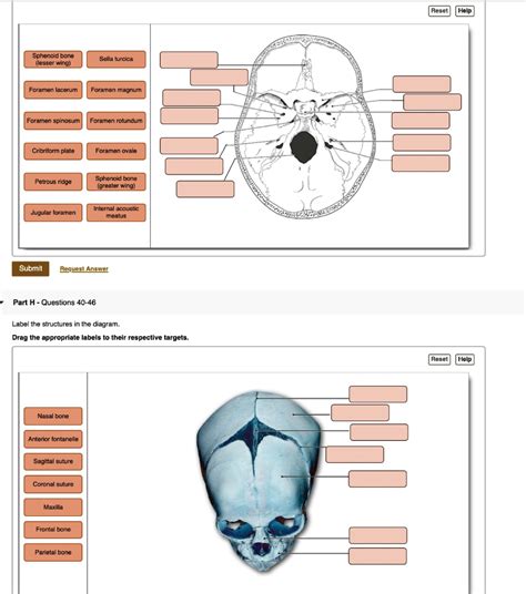 SOLVED: Sphenoid bone (lesser wing) Sella turcica Foramen lacerum Foramen magnum Foramen ...