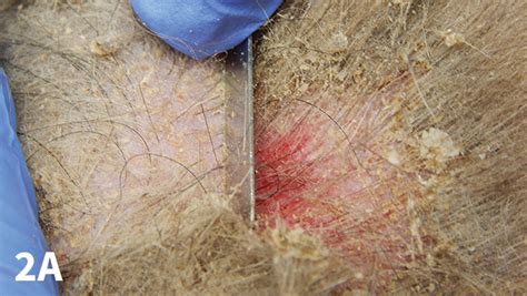 Skin Scraping for External Parasites | Clinician's Brief