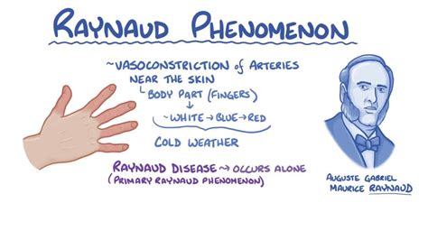 Raynaud phenomenon: Video, Anatomy & Definition | Osmosis