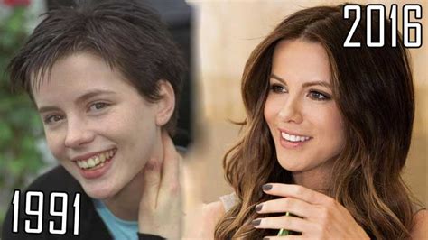 Kate Beckinsale Plastic Surgery: Boob Job, Nose Job, Botox and Teeth