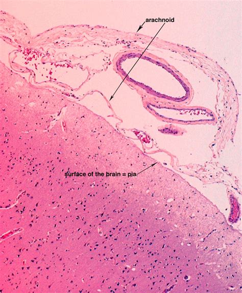 Arachnoid Mater Histology