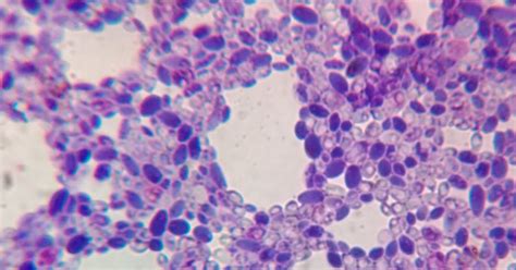 Bacillus Microbiology: Monochrome staining of yeast : Saccharomyces ...