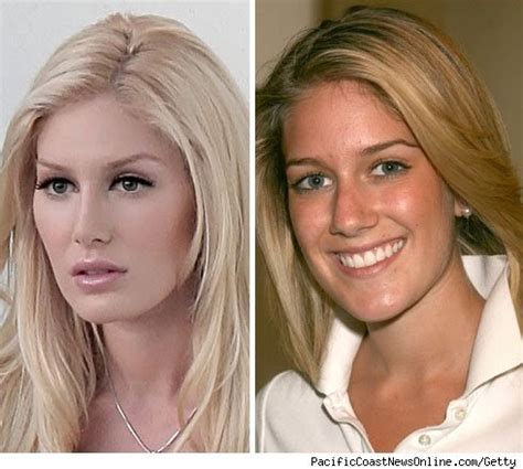 Extra Gossip: Heidi Montag Before And After Pictures Collection : You ...