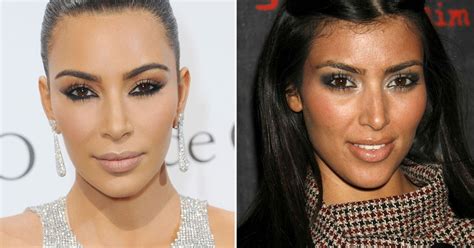 Kim Kardashian's plastic surgery timeline in full as star exposes her 'injected bum' in tiny ...