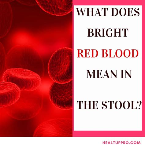 Stools With Blood / What Does Your Poop Say About Your Health Medical Offices Of Manhattan ...