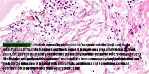 fungal pneumonia | Tumblr