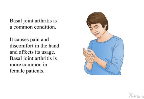 PatEdu.com : Basal Joint Arthritis