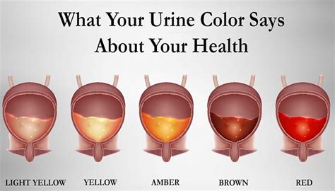 Here’s What The Color Of Your Urine Says About Your Health