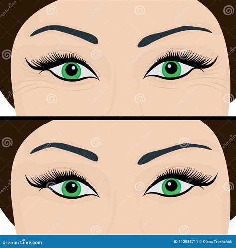 Wrinkles and Fine Lines Under Eyes To Remove. before and after Stock Vector - Illustration of ...