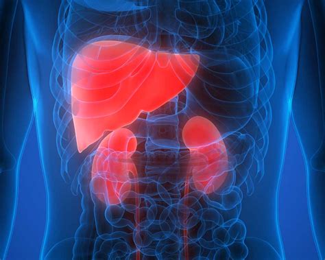 Cirrhosis as related to Ascites - Pictures