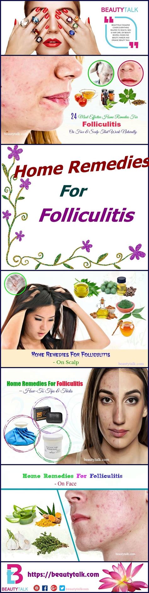 24 Most Effective Home Remedies For Folliculitis On Face & Scalp That ...