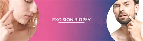 Best Excision Biopsy Treatment In Hyderabad | PrettyU