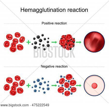 Hemagglutination Vector & Photo (Free Trial) | Bigstock