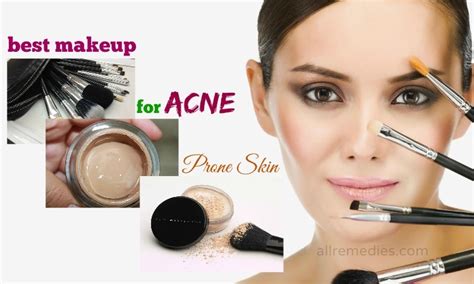 What is The Best Makeup for Acne Prone Skin: 17 Tips