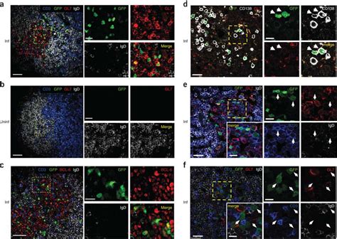 Immunofluorescence confocal microscopy of IgE+ germinal-center cells ...