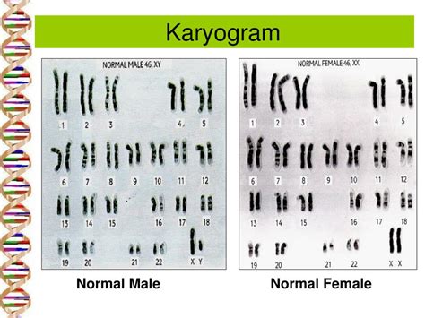 PPT - Karyogram and karyotype PowerPoint Presentation, free download - ID:151187