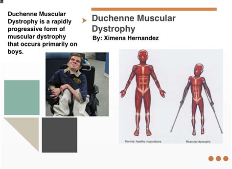 Duchenne Muscular Dystrophy on FlowVella - Presentation Software for Mac iPad and iPhone