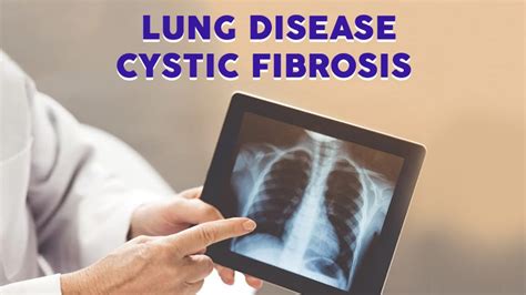 Lung Disease: Cystic Fibrosis - Dr. Rajat Trehan