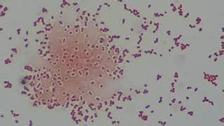 Acinetobacter Baumannii Gram Stain