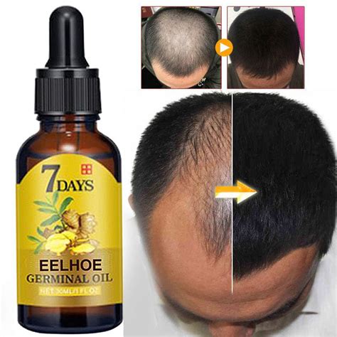 Hair Growth Serum – Bio Shop Beauty