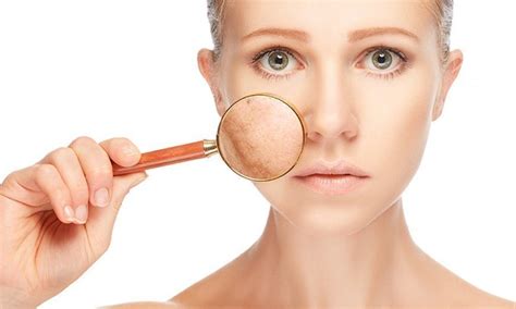 Can Red Light Therapy Make Melasma Worse? | InfraredGlow
