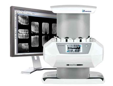 Air Techniques, ScanX Intraoral VIEW, Digital Radiography | WDA Equipment Solutions