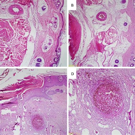 Tail histology of rats. A and B: Control group rats with normal tail... | Download Scientific ...