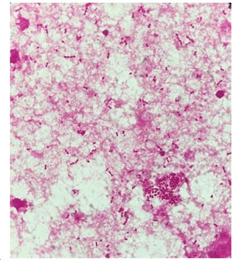 Gram Negative Cocci Blood Culture