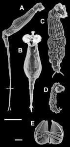 Pseudocoelomate - Definition and Examples | Biology Dictionary