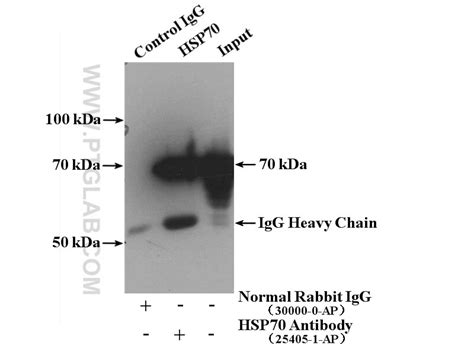 HSPA1B antibody (25405-1-AP) | Proteintech