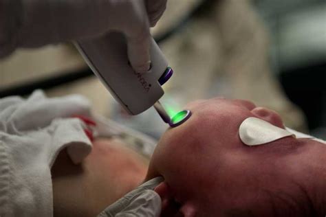 Lighting the way: An invention for safe vascular birthmark treatment ...