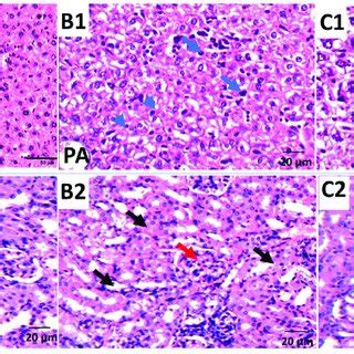 Cell death through autophagy in untreated and treated MDA-MB-231 cel... | Download Scientific ...