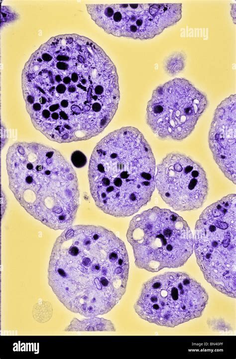 Platelets Under Microscope