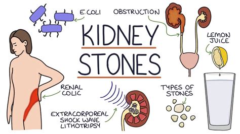 Are Kidney Stones In Dogs Painful