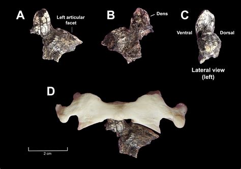 Oldest axial fossils discovered for the genus Australopithecus