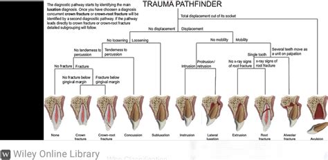 Treatment Of Dental Trauma | Soma Endodontics